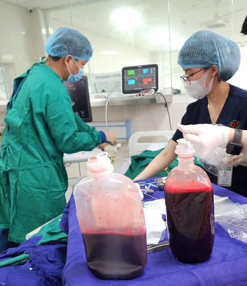 Bệnh viện đa khoa Việt Đức thực hiện kỹ thuật chọc hút dịch màng tim dưới hướng dẫn của siêu âm